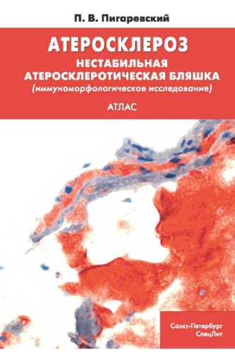 Атеросклероз